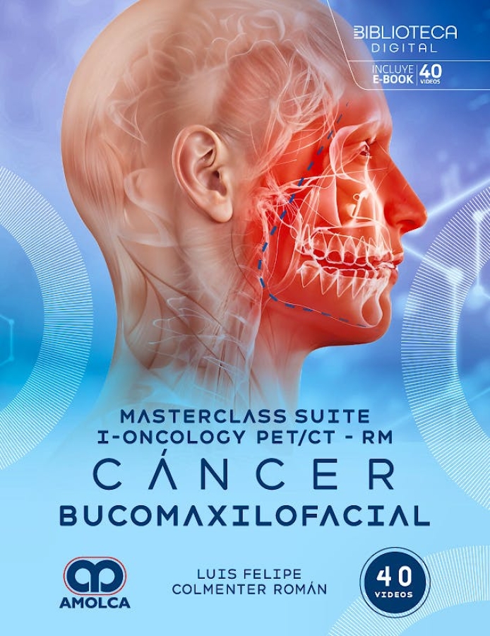 MASTERCLASS SUITE I-ONCOLOGY PET-CT - RM. CÁNCER DE TIROIDES
